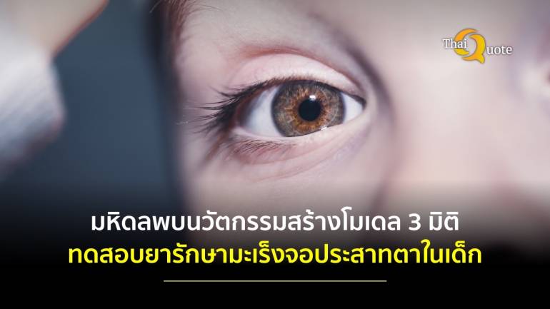 ไม่แพ้ใครในโลก! ครั้งแรกของโลกมหิดลพบการสร้างโมเดล 3 มิติ เพื่อทดสอบยารักษามะเร็งจอประสาทตาในเด็ก