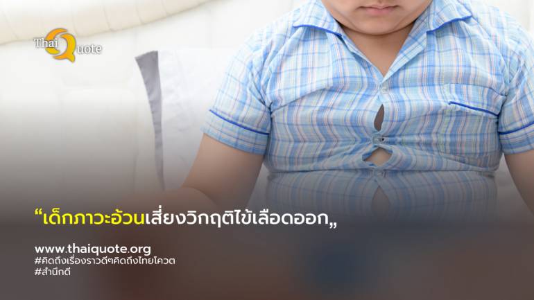 ผู้ป่วยเด็กภาวะอ้วนเสี่ยงวิกฤติไข้เลือดออกรุนแรงมากขึ้นในช่วงเข้าหน้าฝน