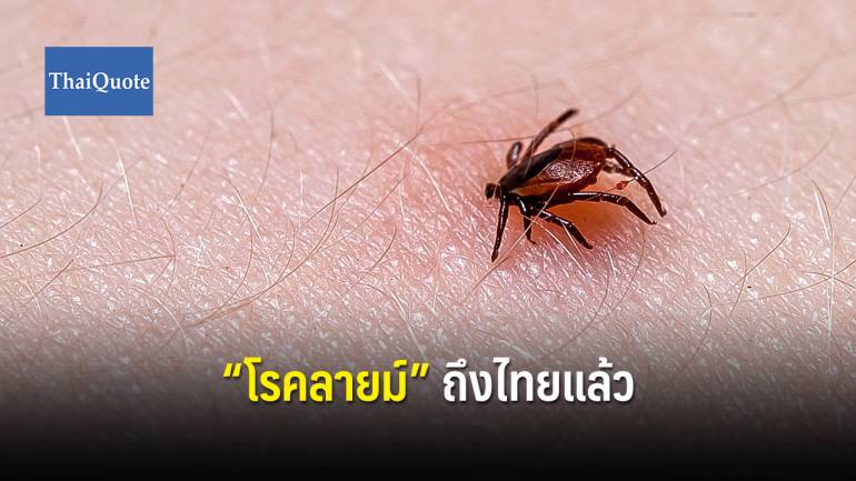 แพทย์เตือนนักท่องเที่ยวไทย ระวังติดเชื้อโรค “ลายม์”