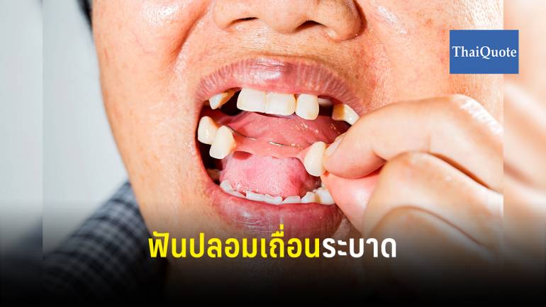 เตือน ! ฟันปลอมเถื่อนมีจุกยางที่เพดานปากอันตราย เสี่ยงเพดานปากทะลุ  